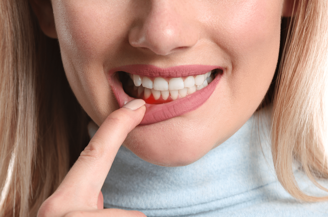 periodontal therapy for woman with gum disease